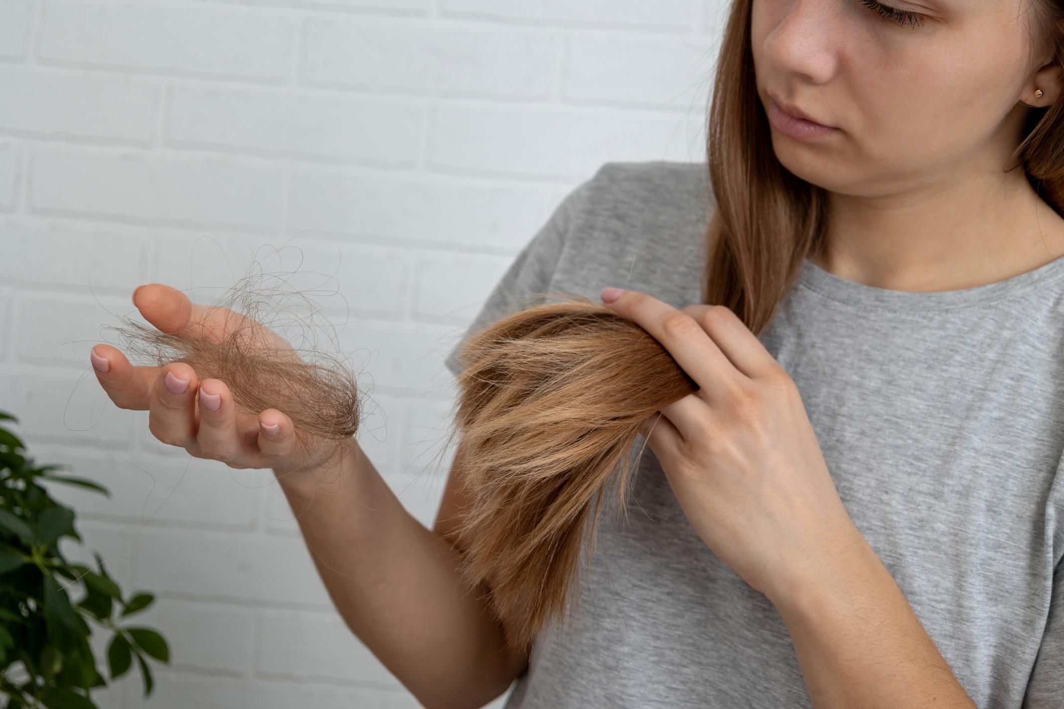 kvinnligt håravfall kvinna med tunt hår